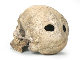 Crani trepanat corresponent a un home. Foto: J. Casanova. AMG.